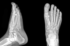 calgary podiatrist